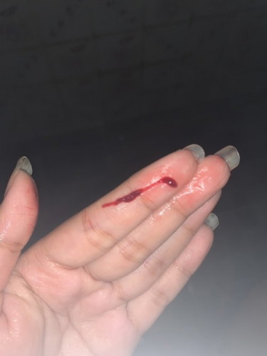 หลังฉีดยากันแท้ง