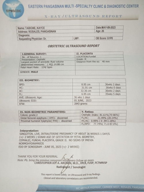 Hi mga mie. Ano po ibig sabihin ng fundal placenta? Thanks po sa sasagot😊