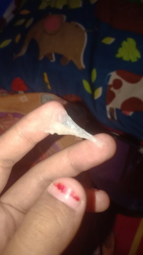 Hamil 24 week keluar gumpalan