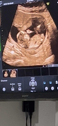 แม่ๆช่วยดูหน่อยค่ะ แบบนี้ผญ/ผชหรอค่ะ