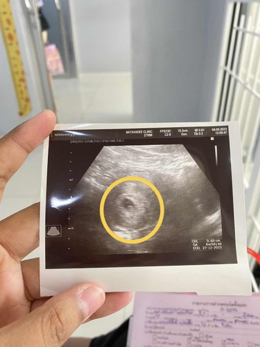 แม่ๆคะ แบบนี้คือเจอน้องแล้วใช่ไมคะ