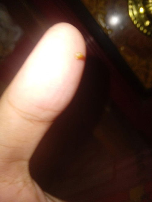 Mau nnya dong bun tadi ku ngeluarin lendir keputihan tapi kecoklatan kya gini?? Kira" ini apa ya bun