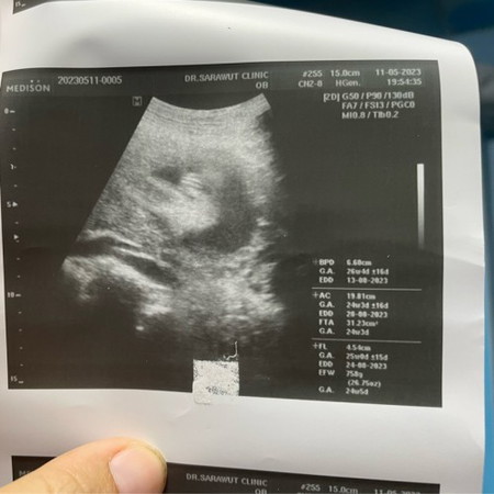 แม่ๆช่วยดูหน่อย