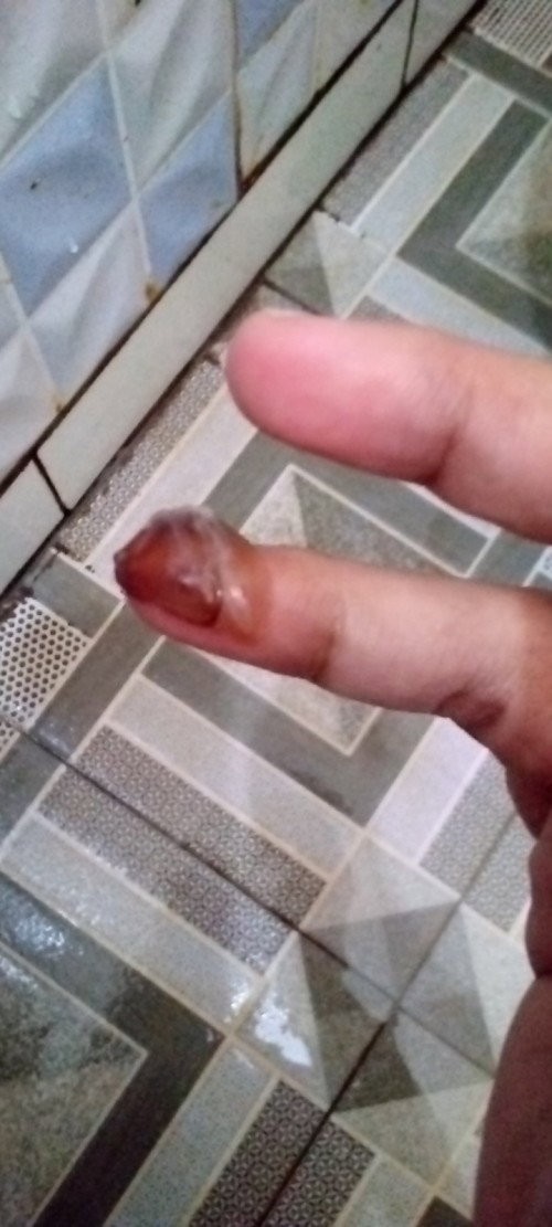 Bunda², kalau gini langsung ke dokter apa tunggu nanti aja yaa??