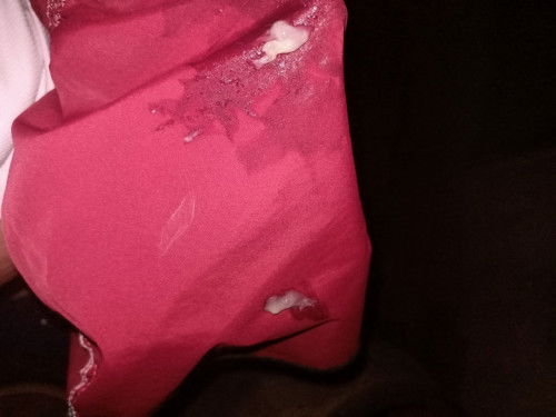 กลัวเจ็บท้องก่อนได้ผ่า