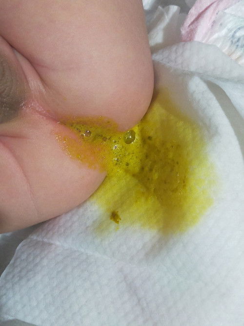 Bakit ganyan dumi ni baby?