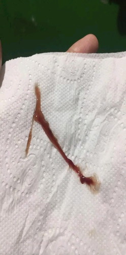 PA HELP MGA MOMSH MUCUS PLUG BO BA ITO?