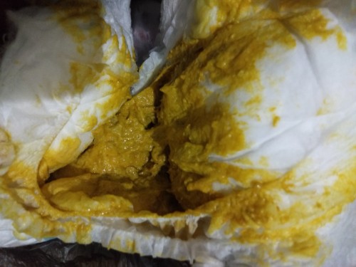 Anakku usia 6 bulan 20 hari, 2 hari ini sring bab 3x shri, apkah wjr y bund? Ada yg prnh mngalmi?