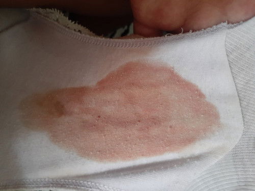 Normal  ba labasan ng dugo while nag lalabor