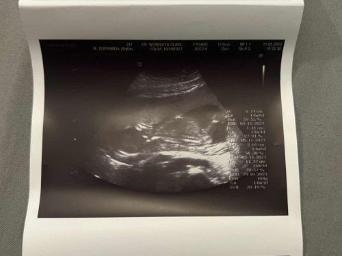 15W ประมาณกี่เดือนคะ