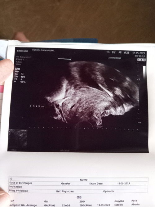 ภาพอัลตาซาวน์🥰