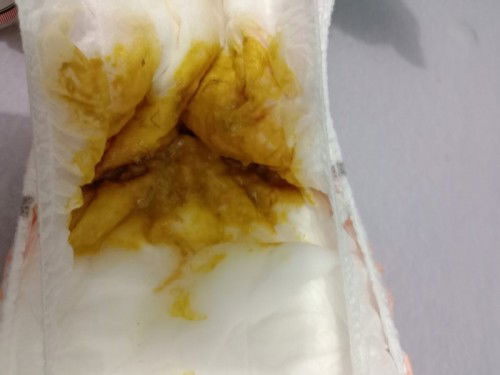 Hello pa help nmn po ano po kaya ito about sa pupu ni baby kada kain kada Dede natae Pina check ko