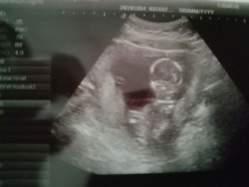 แม่ช่วยดูหน่อยว่าน้องเป็นเพศอะไร