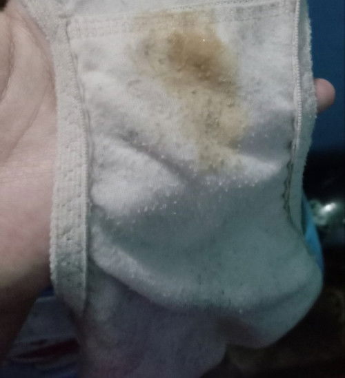 HPL 11 MEI, sudah keluar lendir darah 3 hari,tapi belum ada mules/kontraksi