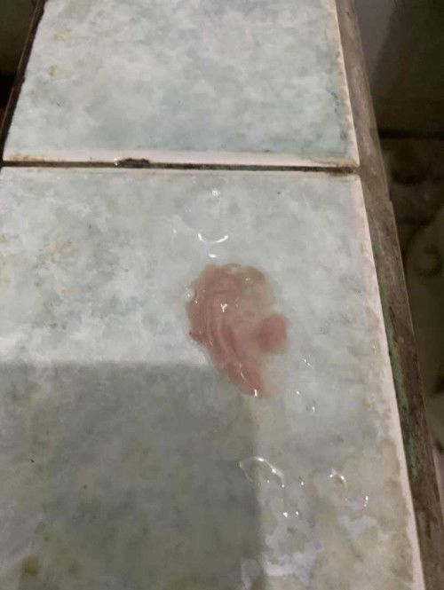 cara cepat menambah pembukaan stuck di 2 tapi keluar flek terus