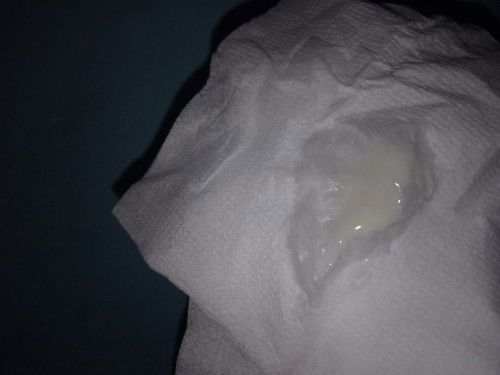 Normal apa enggak bun