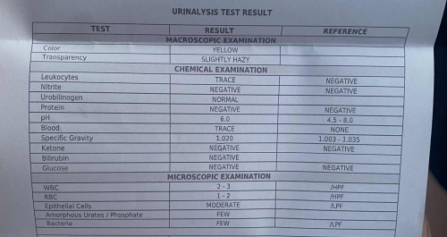 URINALYSIS