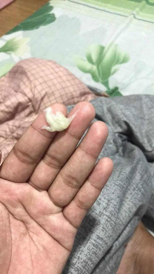 มีมูกขาวใสปนขุ่น