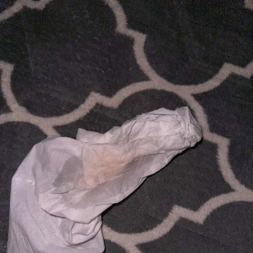 apakah itu keputihan?