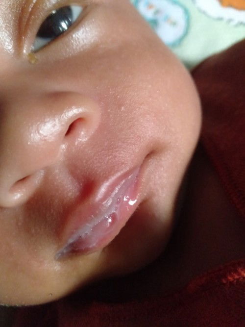 Main gelembung air liur