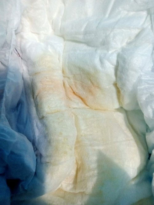 Anak ku tadi pagi pipis nya kemerahan ini termasuk normal engga ya mam? Anak usia 3bulan