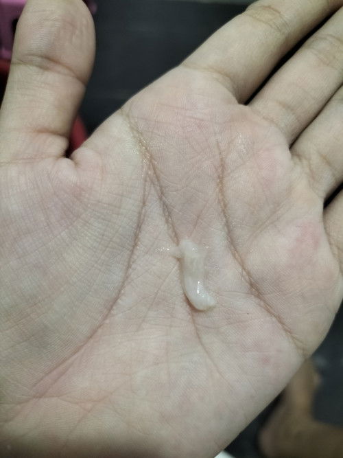 แบบนี้คืออีกกี่วันคลอดหรอคะ มันคือสัญญาณเตือนหรือป่าวคะ