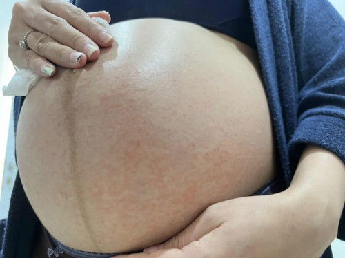 Ada yang pernah ngalamin ini ? Recommend obatnya dong