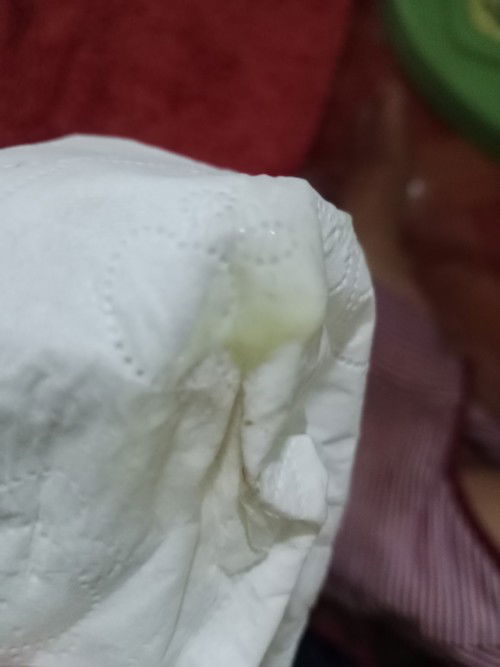 มีมูกแบบนี้ออกมาตอน34วิค