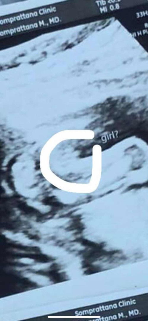 แม่ๆช่วยดูหน่อยค่าา