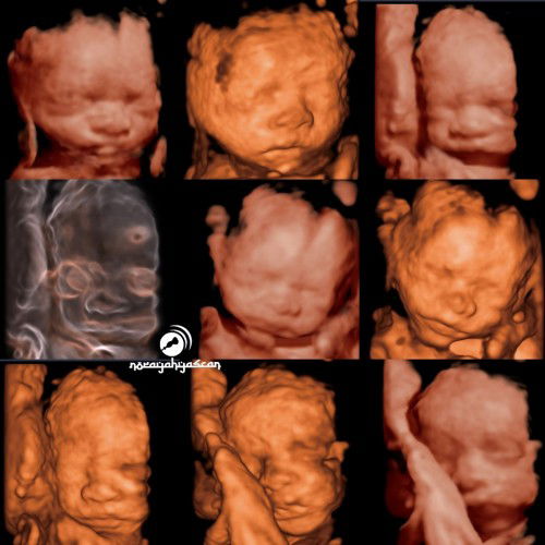 Detail scan vs 3d4d scan