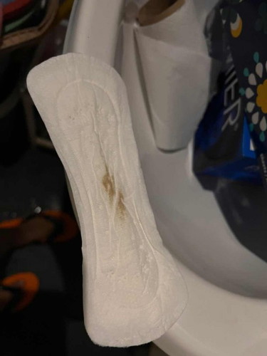 12weeks 2 days pregnant, normal kah bila keluar light spot cokelat muda