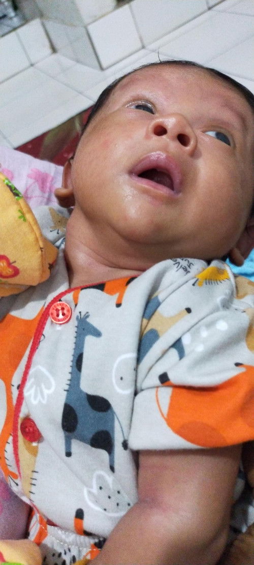 Tulang leher menonjol