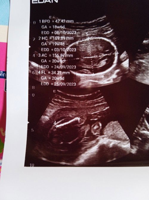 แม่ๆๆช่วยดูในหน่อยค่ะว่าน้องมีสิทธิ์จะเป็นเพศไหน