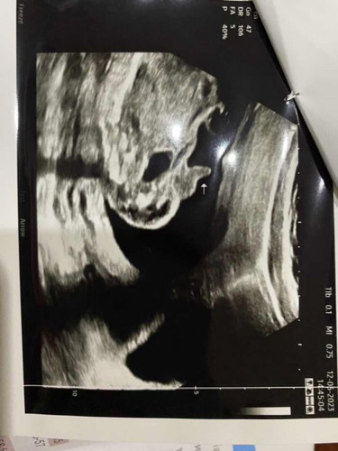 อยากทราบเพศลูก