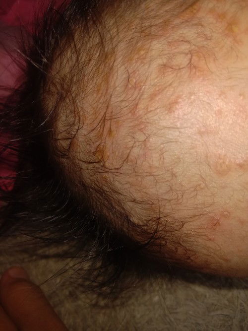 Bunda lainnya juga pernah ngalamin anaknya kayak gini gk?