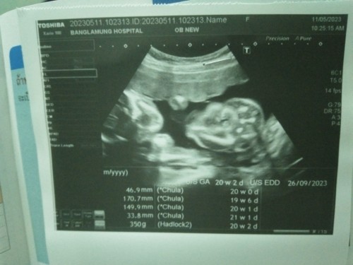 อยากทราบเพศลูกค่ะ