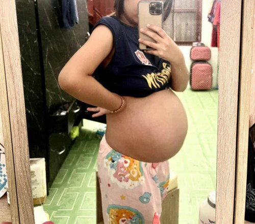 มีแม่คนไหนท้องไม่ลงต่ำ แต่คลอดเลยไหมคะ