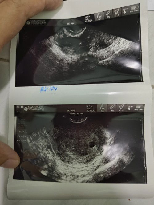 มีใครเคยเป็นแบบนี้ไหมคะ