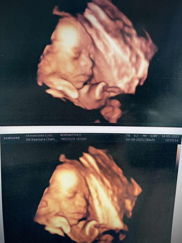 ซาวด์28 w 4 มิติ