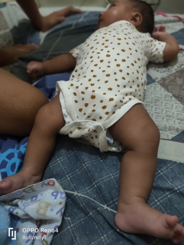 Namamaga ang kabilang paa .