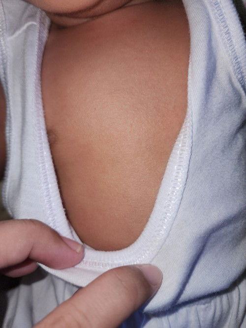 Rashes? Allergies? What to do?