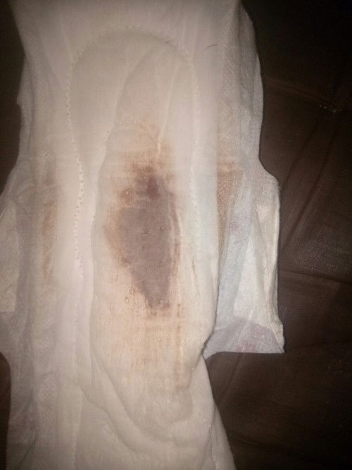 Maaf agak jorok gmbar foto nya bunda,mau nnya dong bunda belum telat haid kenpa kluar brcak trus ya.