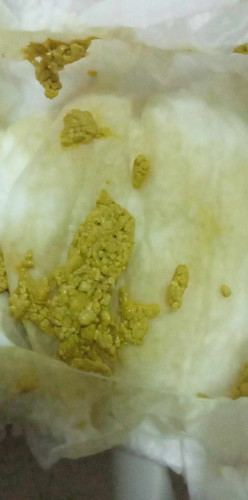 เปลี่ยนนมเป็นเอนฟาแล็คเอพลัส