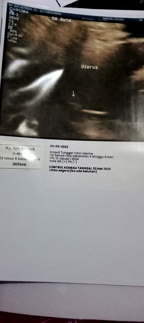 Bingung hasil keterangan usg