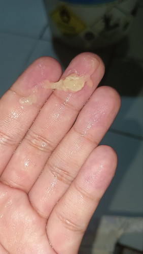 Yellow discharge???