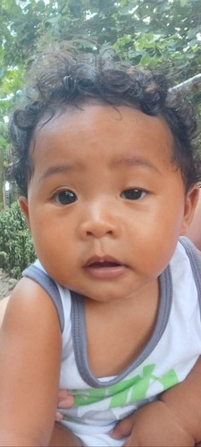 Hindi pantay mata ni baby