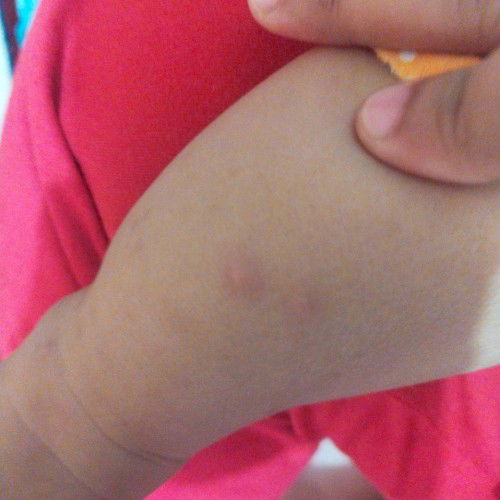 bun ada yg tau ini kenapa ya? bintik-bintik putih pada kaki ada yg aga merah juga