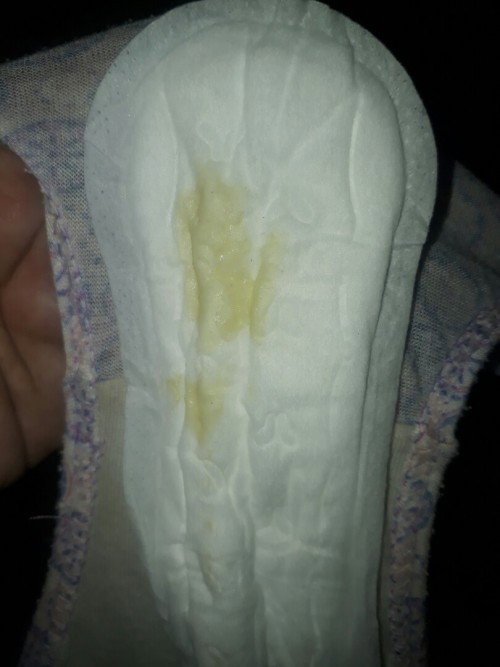 Discharge 39weeks Preggy