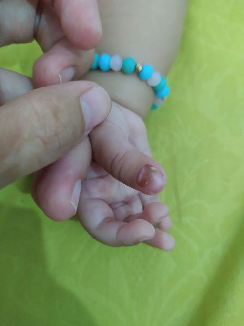 Kuku bayi terlihat coklat