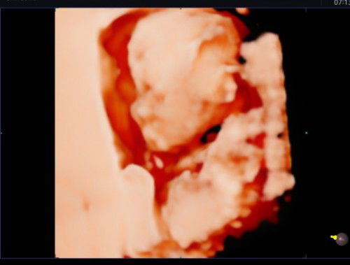 30w JK cewe usg trakhir pas 5bln